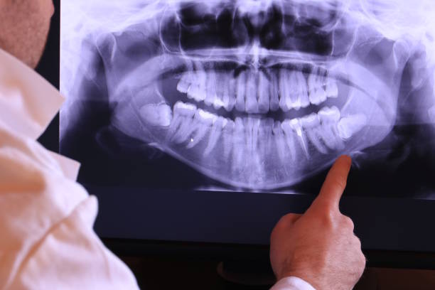 Best Tooth Pain Emergency Relief  in Bigfork, MT